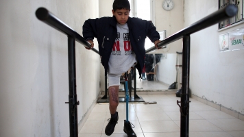 A boy who lost his leg during the war in Syria.