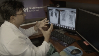 A doctor at Northwestern Medicine looks at X-rays of lungs