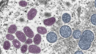 monkeypox virus particles, obtained from a clinical sample associated with the 2003 prairie dog outbreak