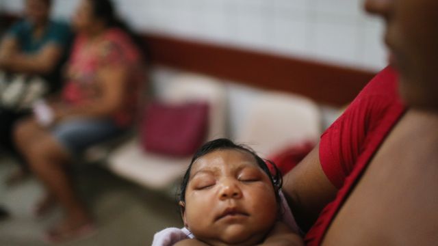 A baby with microcephaly at a hospital in Brazil.