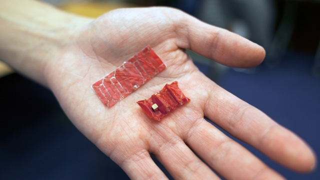 This origami robot can be used to get batteries out of kid's stomachs.
