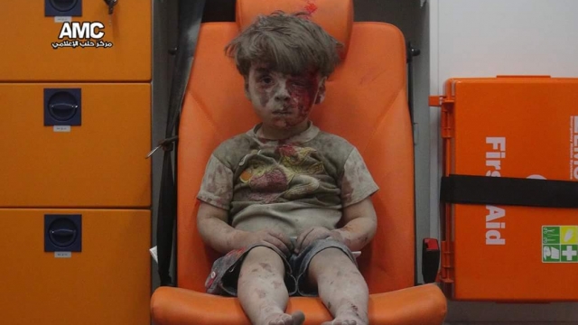 An injured 5-year-old boy sits inside an ambulance in Aleppo, Syria.