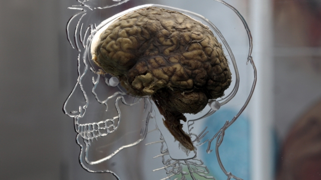A human brain is displayed as part of an exhibit.