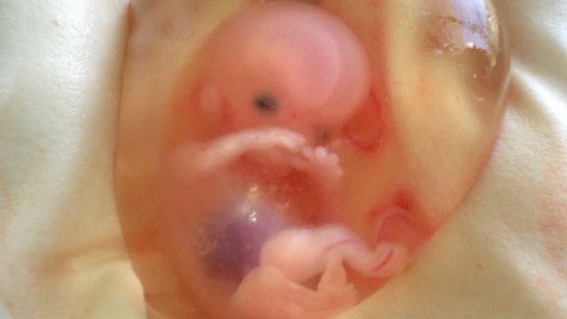 A 10-week-old human fetus