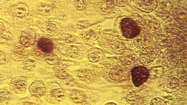 This photomicrograph reveals McCoy cell monolayers with Chlamydia trachomatis inclusion bodies.