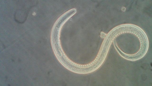 Hookworm under a microscope