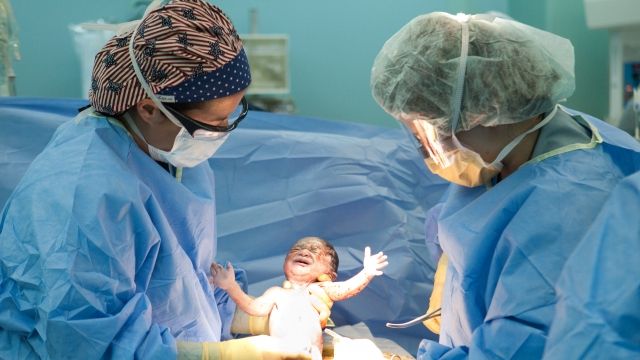 Doctors deliver a baby by C-section.