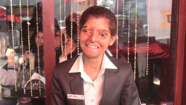 An acid attack survivor who's employed at Sheroes Hangout