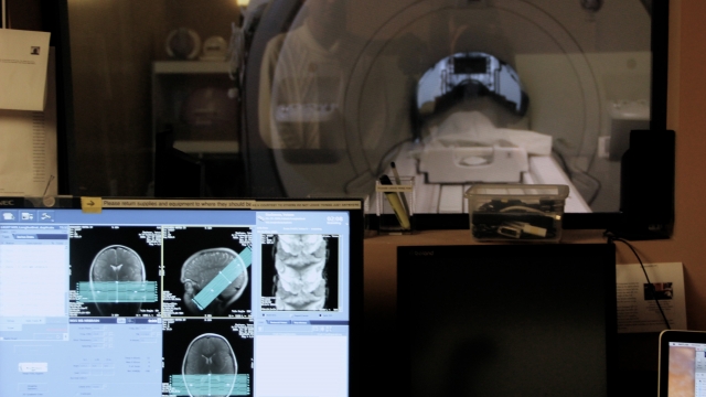 MRI lab and brain scans