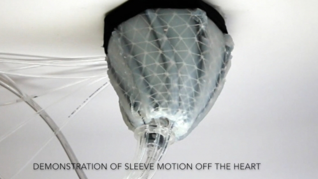 A flexible, heart-augmenting robot
