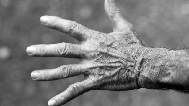 Wrinkled hand of an aged person