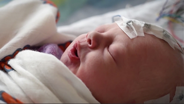 Newborn baby hooked up to brain monitor