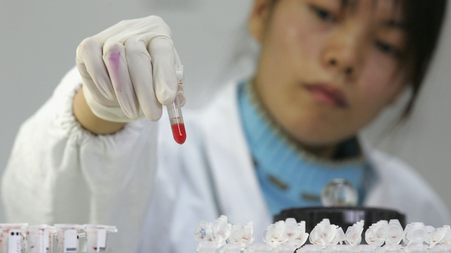 A Chinese lab worker runs an HIV test