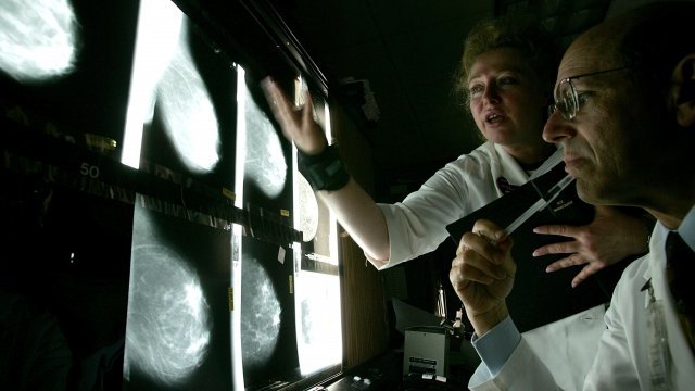 Doctors examine breast X-rays