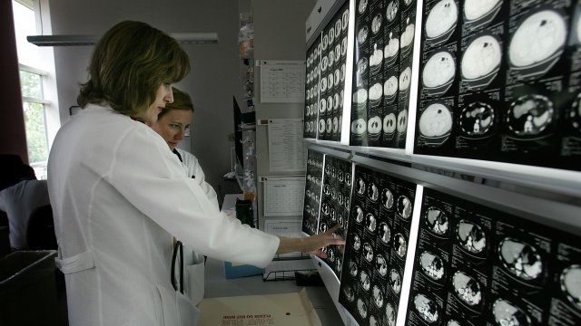 Doctors review PET scans of cancer patients