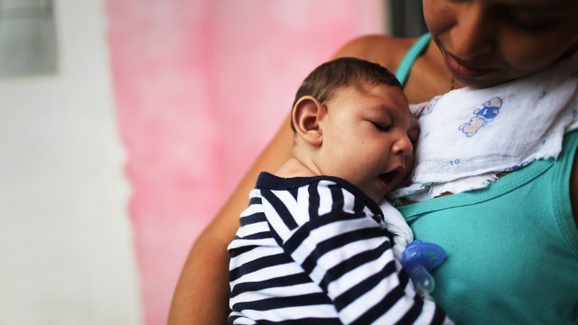 Baby with microcephaly, a defect linked to Zika