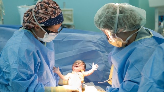 Doctors deliver a baby girl by C-section.