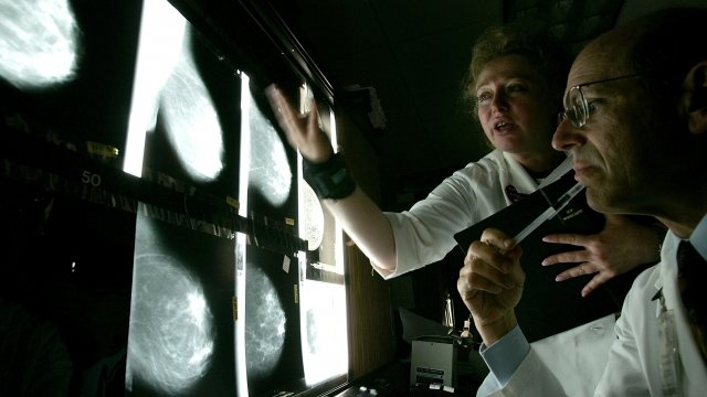 Doctors look at breast scans