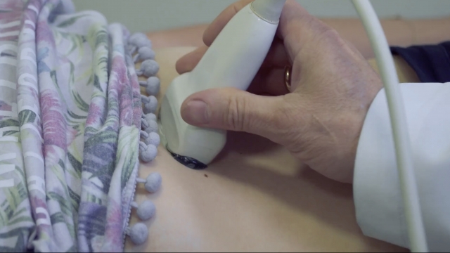 A woman undergoes an ultrasound