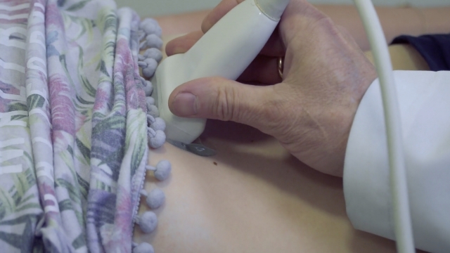 ultrasound on a woman