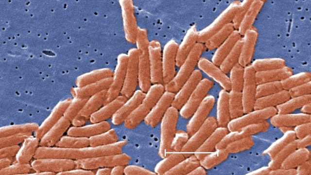 Salmonella Newport bacteria under a microscope