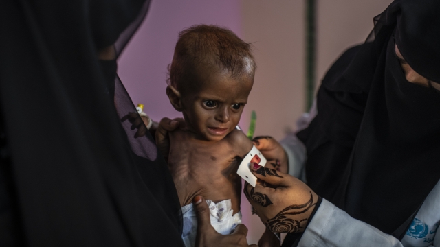 A child in Yemen.