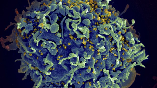 A cell with HIV.