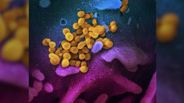 SARS-CoV-2 (yellow)—also known as 2019-nCoV, the virus that causes COVID-19