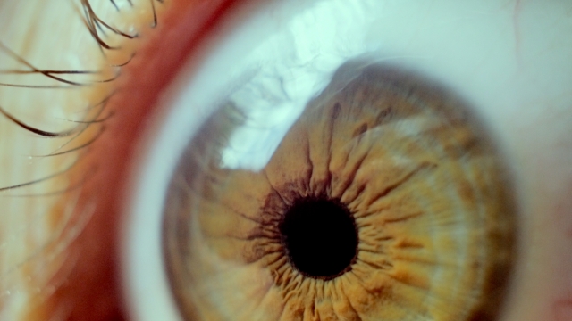A person's eye.