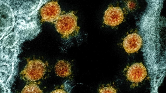 This microscope image from the National Institute of Allergy and Infectious Diseases shows SARS-CoV-2 virus particles.
