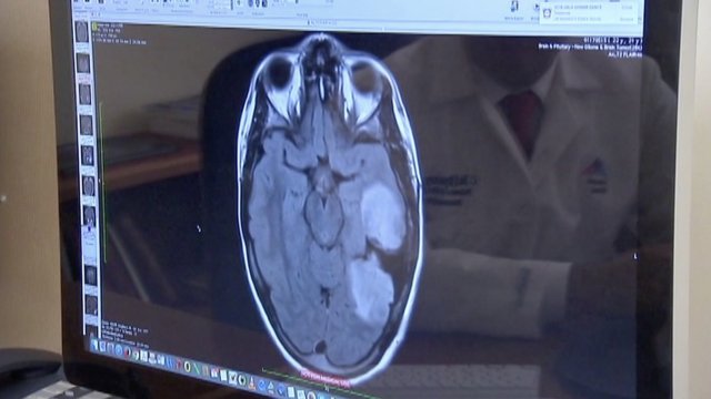 A brain scan.