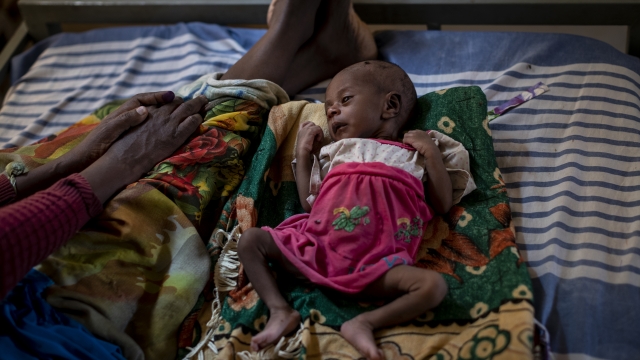 A woman sits with her malnourished daughter in a medical clinic treatment tent in Abi Adi in the Tigray region