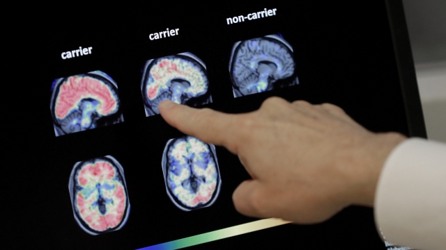 A brain positron emission tomography scan.