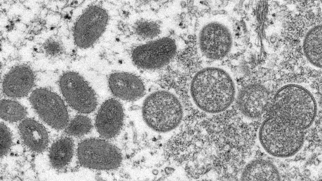 Mircrosope image of monkeypox virions.