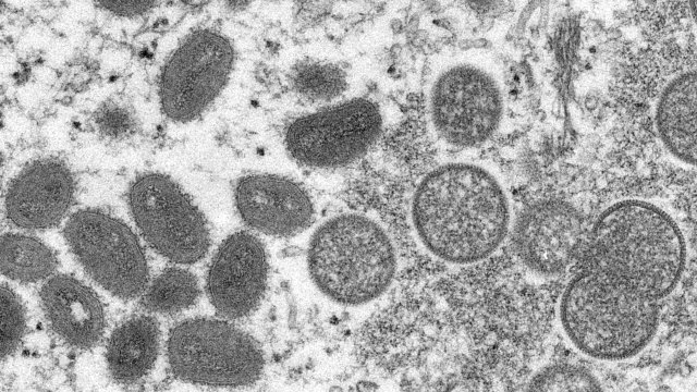A microscope image made available by the Centers for Disease Control and Prevention shows the monkeypox virus.