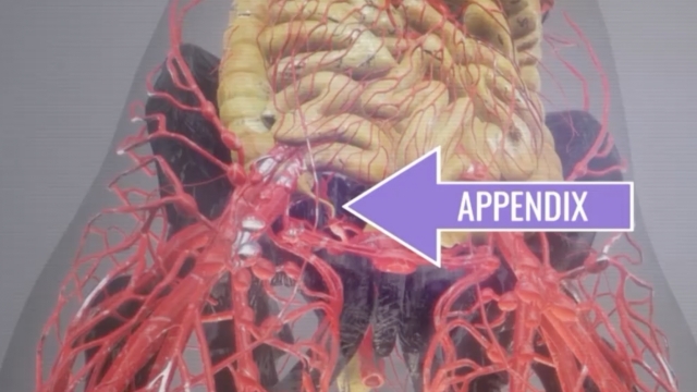 A photo of where your appendix is located