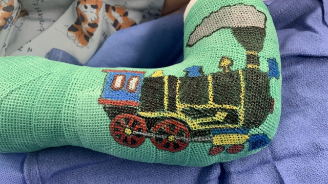 After Dr. Felicity Fishman finishes a surgery, she draws a unique piece of art on the cast.