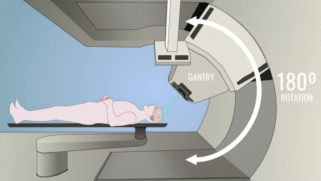 Animation of a proton therapy treatment gantry.