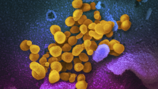 Colorized electron microscope image shows the Novel Coronavirus SARS-CoV-2