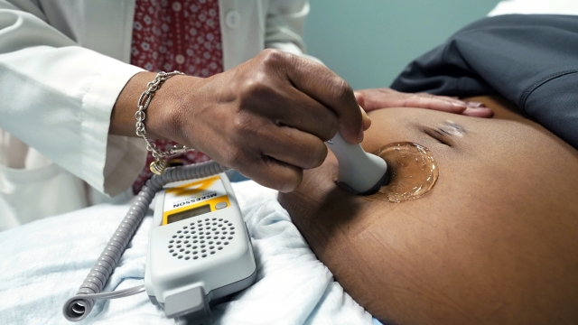 Doctor doing an ultrasound on a pregnant woman