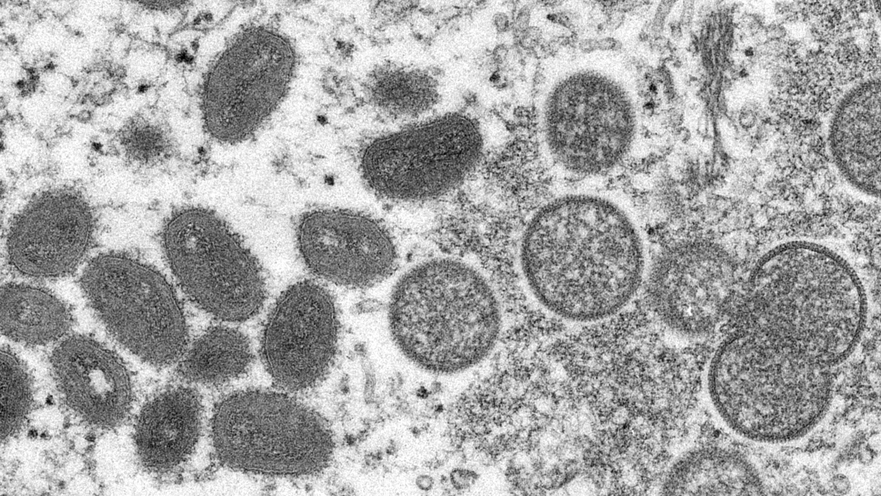 Mature, oval-shaped monkeypox virions, left, and spherical immature virions.