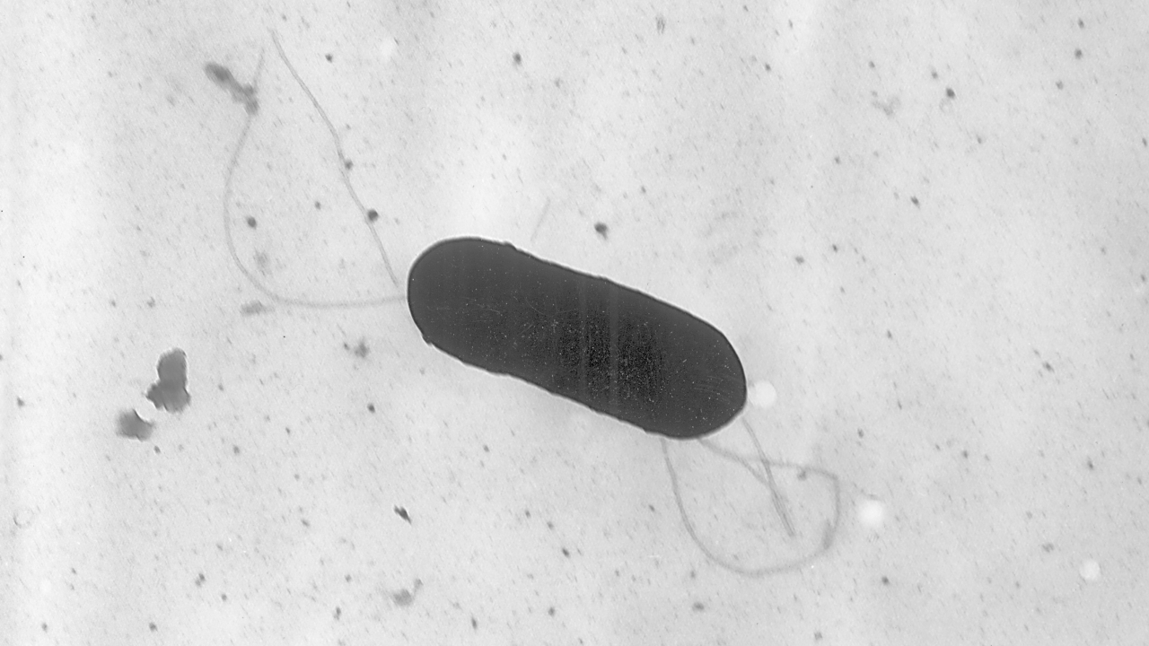 Microscope image of a Listeria monocytogenes bacterium.