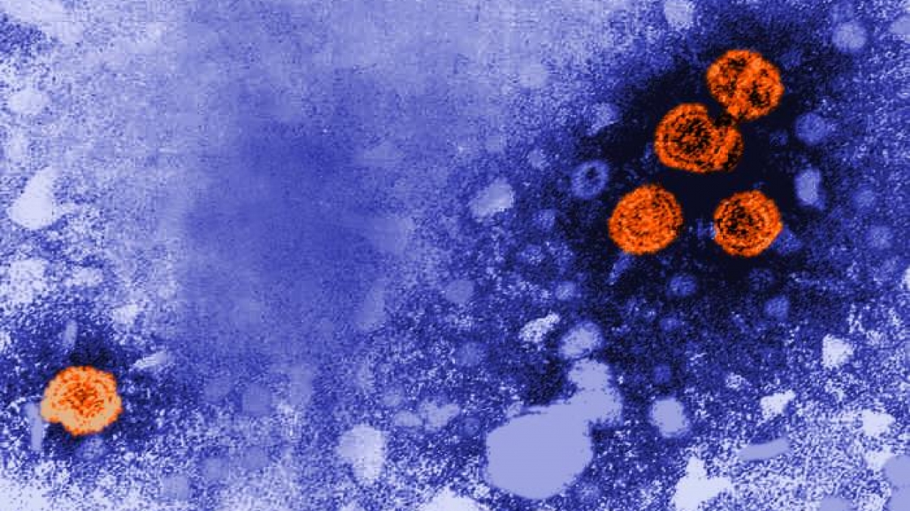 The presence of hepatitis B virus (HBV) particles.