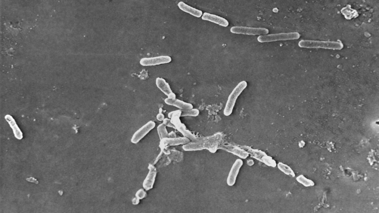 Images shows rod-shaped Pseudomonas aeruginosa bacteria linked to recalled eye drops.