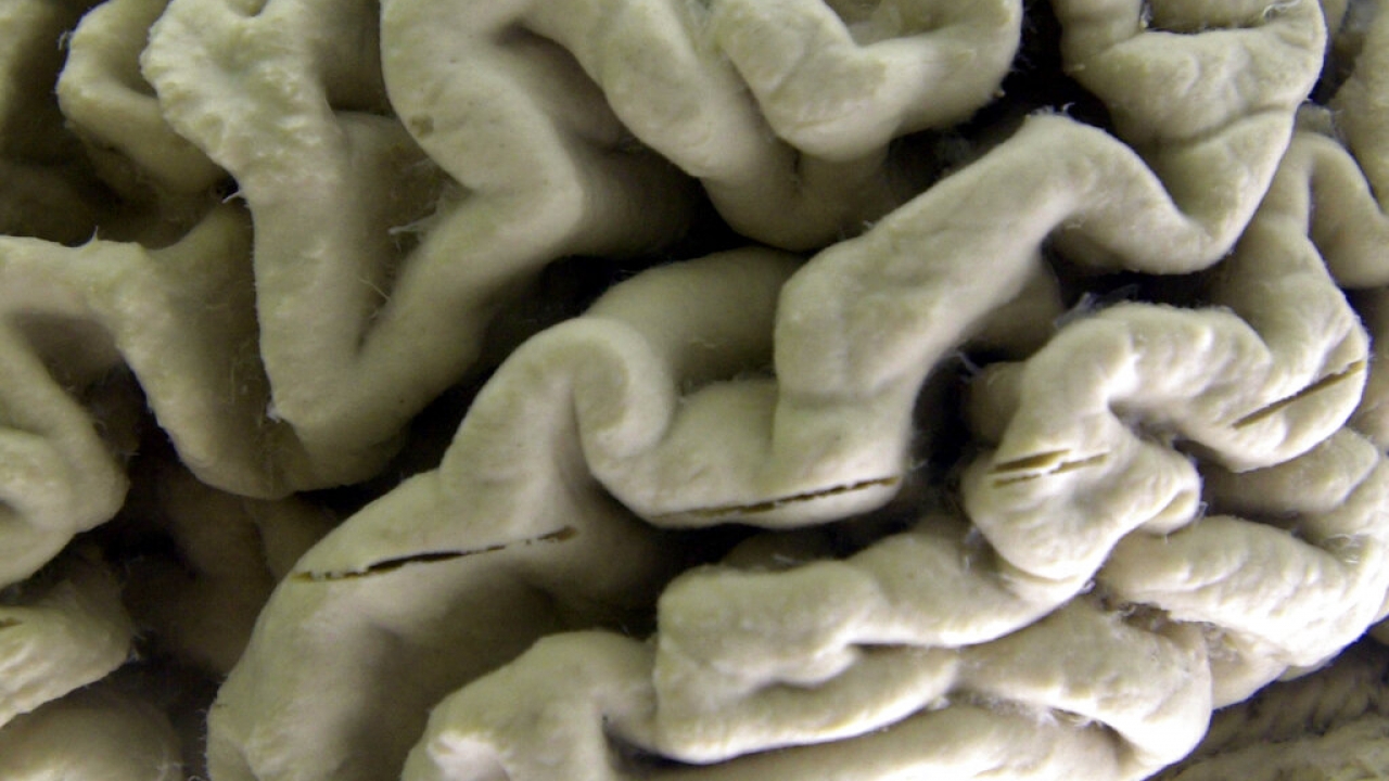 A closeup of the human brain is shown.