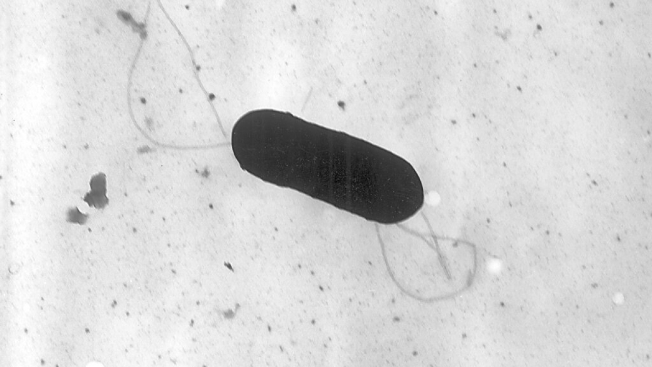 This 2002 electron microscope image made available by the CDC shows a Listeria monocytogenes bacterium.