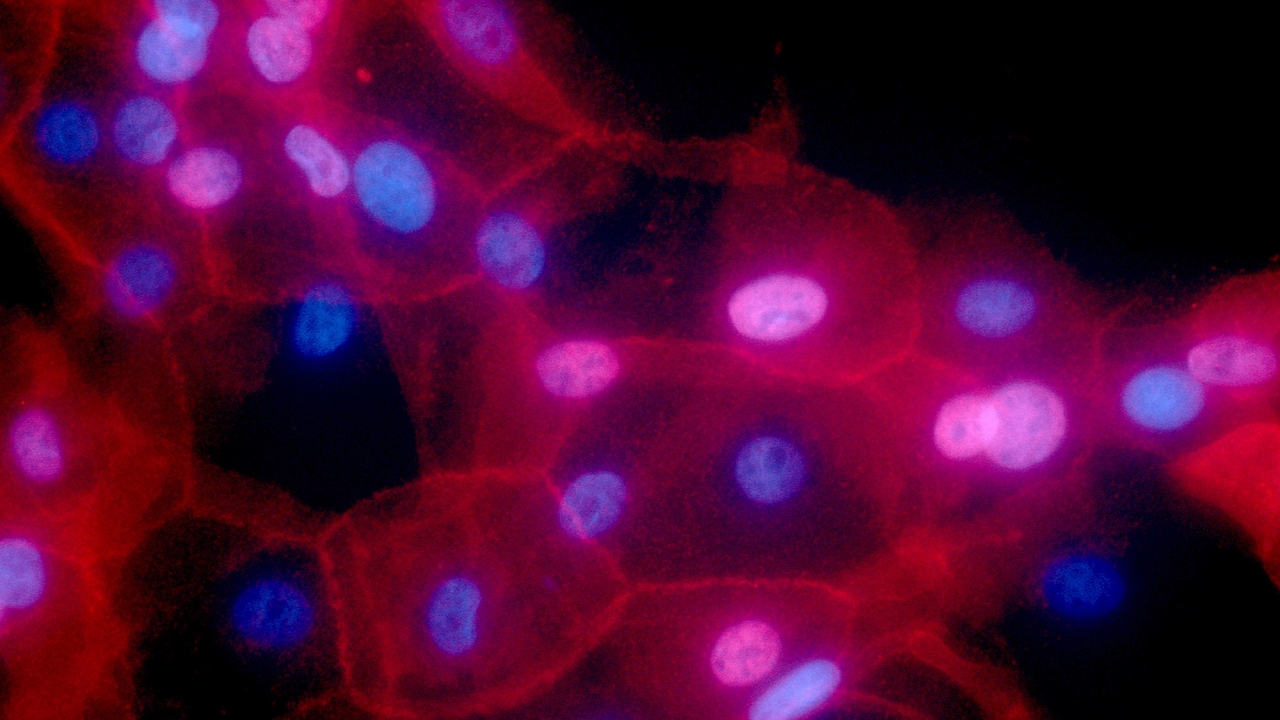 This microscope image by the National Institutes of Health in September 2016 shows a culture of human breast cancer cells.