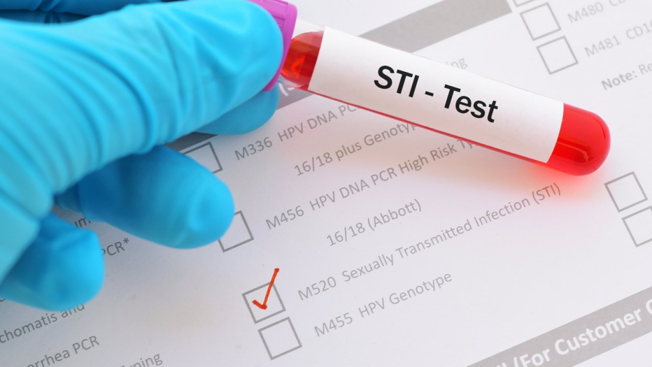 STI test vial and paperwork