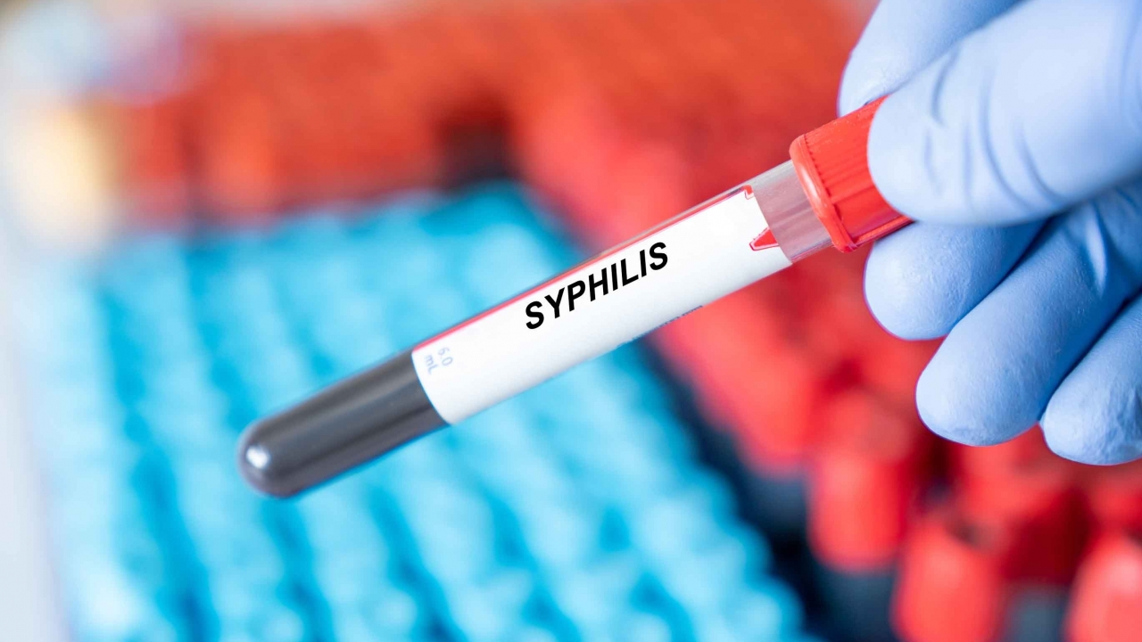 A vial of blood with a "syphilis" label is shown.