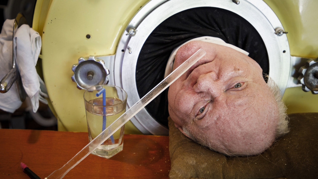 Paul Alexander, who lived in an iron lung, dies at 78